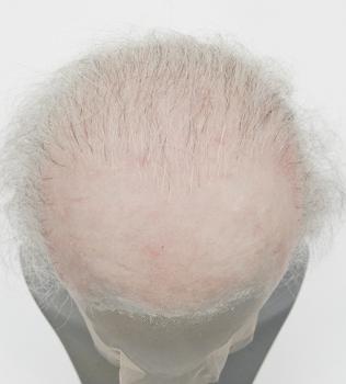 GUNDUL Silicone Bald Wig